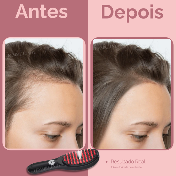 Escova de Terapia Capilar: LedBrush Smarts 4 em 1