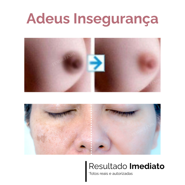 Bioaqua Intimus: Creme Clareador Natural para Corpo e Partes Íntimas