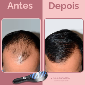 Escova de Terapia Capilar: LedBrush Smarts 4 em 1
