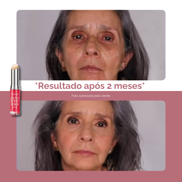 Femme Eye Stick: Bastão Anti-Olheiras e Anti-Idade com Retinol