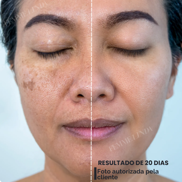 Femme Glow: Esponja Coreana com Remoção de Manchas de Envelhecimento
